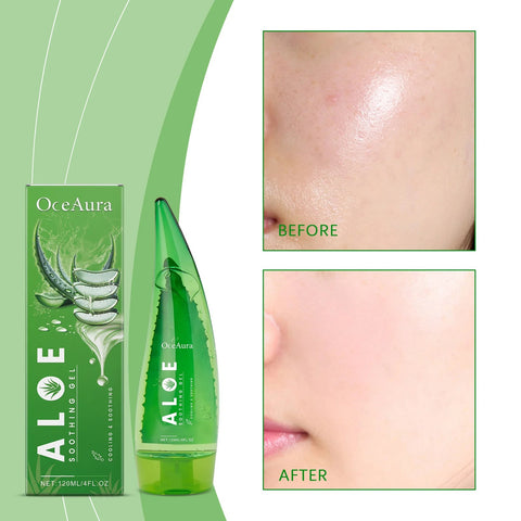 Aloe Vera Gel Skin Lightening Moisturizing